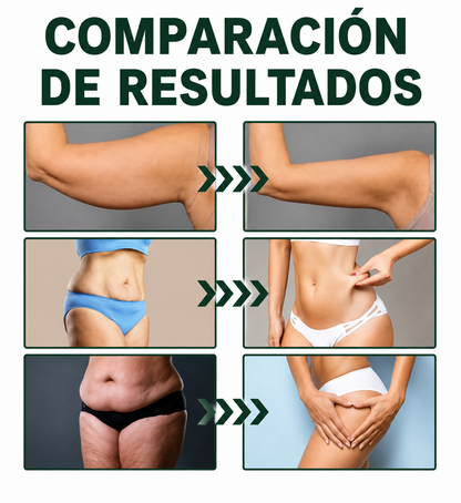 OceAura™ | hasta -98% flacidez